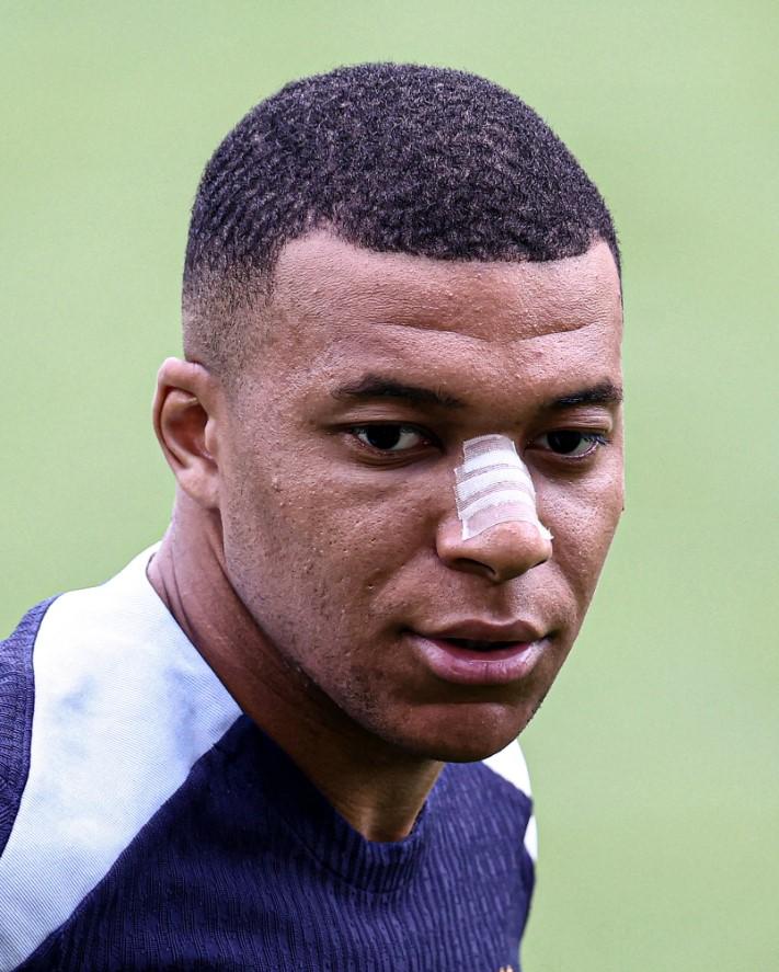 Mbappe bất ngờ tái xuất sau chấn thương gãy mũi báo tin cực vui cho ĐT