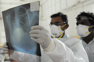 Mexico có ca tử vong do cúm H1N1 đầu tiên trong năm