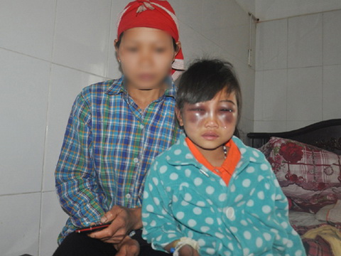 Vụ cô giáo đánh thương tích học sinh ở Phìn Ngan: Công an vào cuộc