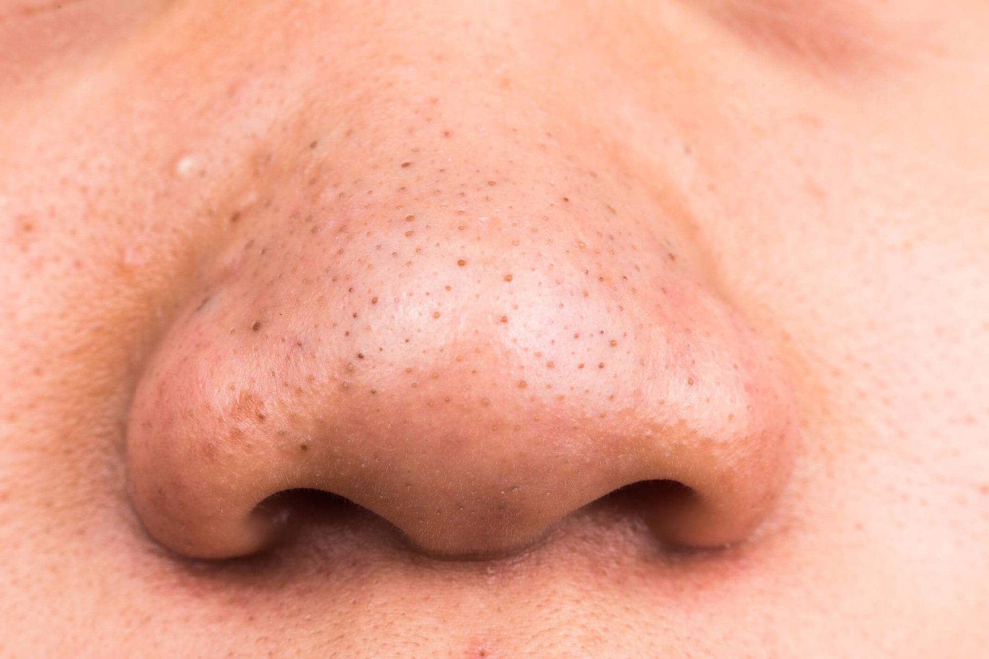 3 dấu hiệu trên khuôn mặt cho thấy phổi đang chứa đầy độc tố, uống 1 ly nước mỗi sáng để thanh lọc, giải độc phổi - Ảnh 1.