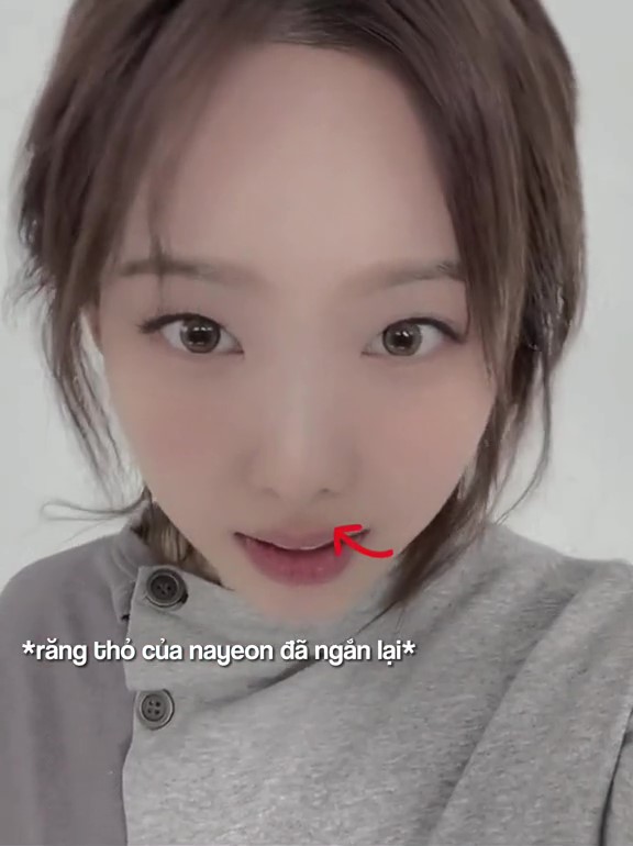 Nayeon vừa sửa 1 chi tiết trên gương mặt khiến netizen vừa mừng vừa tiếc - Ảnh 4.