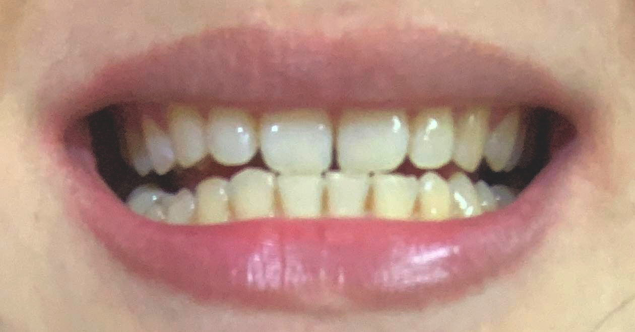 Tôi mua tinh dầu trắng răng để tẩy trắng, sau 1 tháng nhận được kết quả không ngờ - Ảnh 4.