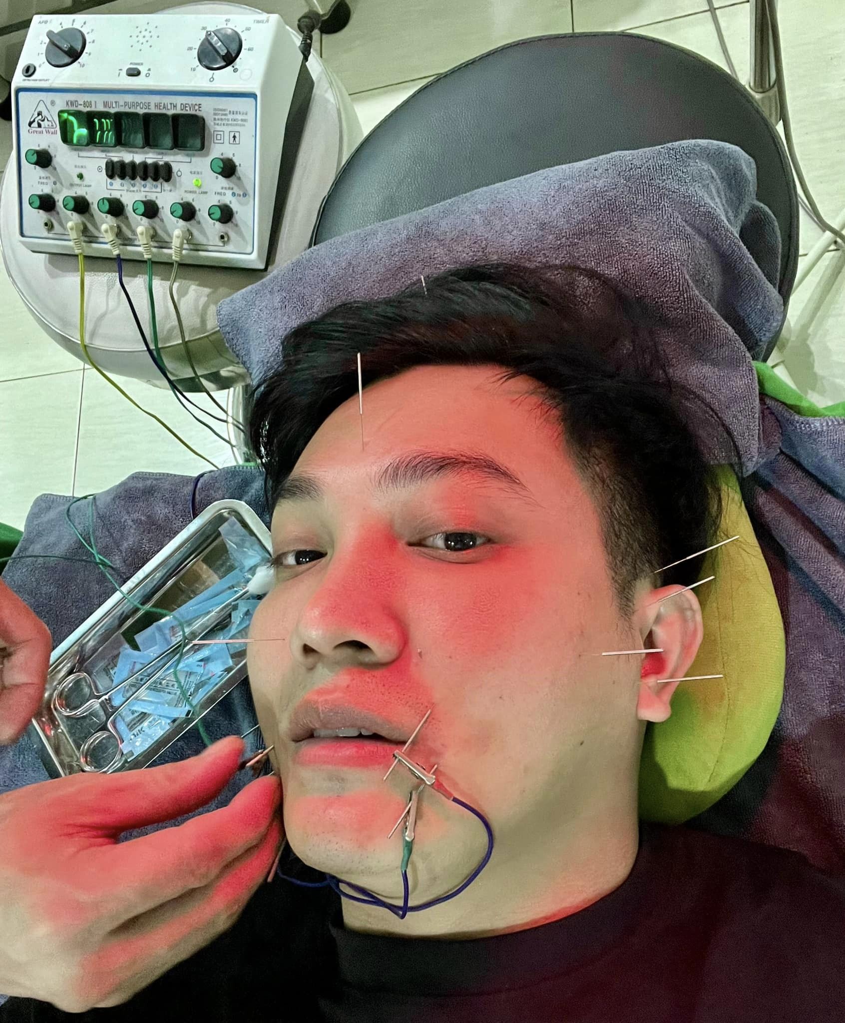 MC Nguyên Bảo hủy hàng loạt show vì mắc bệnh lệch mặt - Ảnh 2.