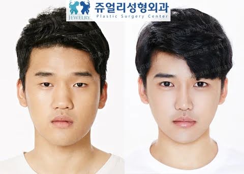 Nam giới ở Hàn Quốc muốn phẫu thuật thẩm mỹ giống 2 thần tượng K-pop này nhất - Ảnh 2.