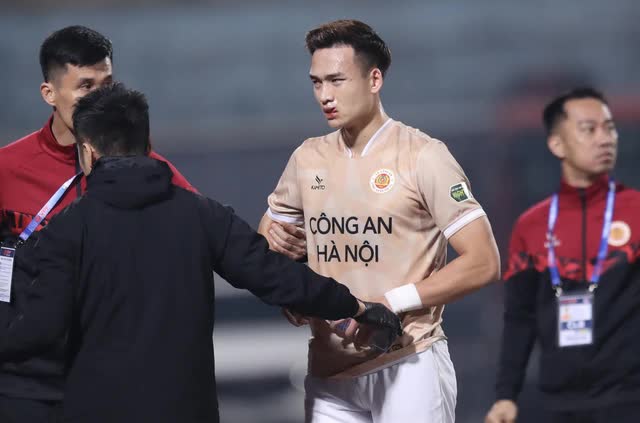 Bùi Hoàng Việt Anh mất ngủ sau chấn thương, bỏ ngỏ khả năng ra sân trận gặp Indonesia - Ảnh 2.