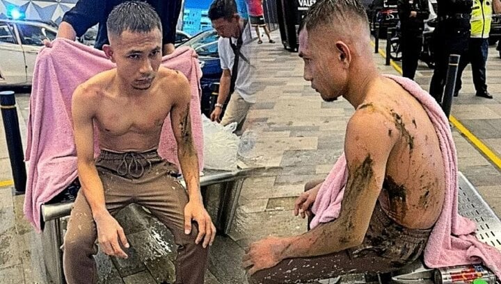 Trước thềm đấu ĐT Việt Nam, 'Ronaldo Malaysia' tái xuất với diện mạo khó tin sau khi bị tạt axit