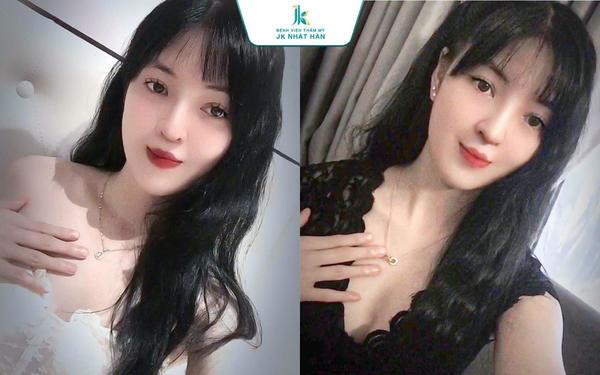 Bệnh viện JK Nhật Hàn giải cứu gương mặt cho cô gái sứt môi nặng - Ảnh 4.