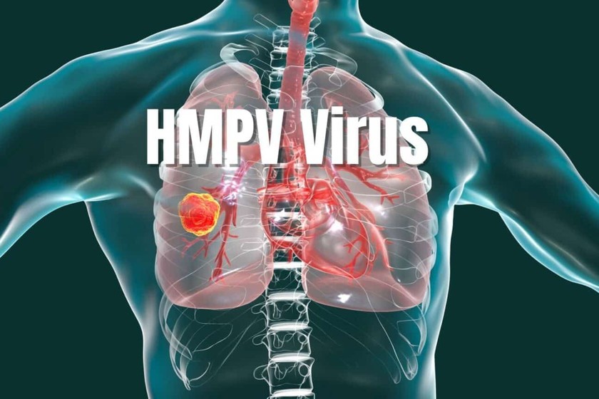 Ấn Độ phát hiện trường hợp đầu tiên nhiễm virus HMPV - Ảnh 1.