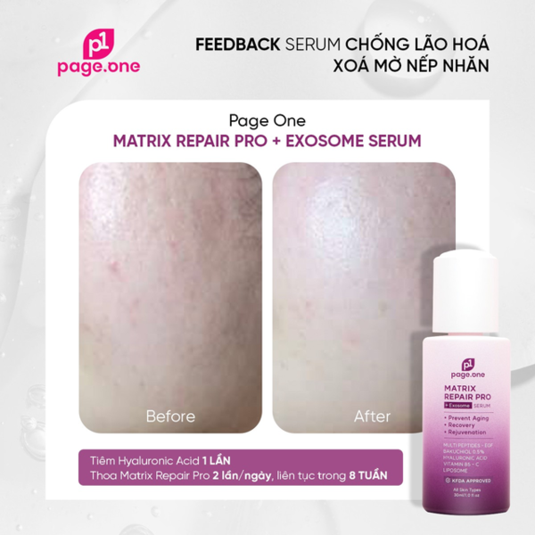 Serum PageOne Matrix Repair Pro + Exosome có ‘thần thành hóa ”quá không? - Ảnh 1.