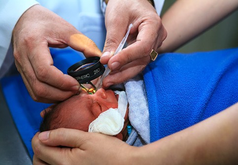 Bệnh lý võng mạc trẻ sinh non - Ảnh 1. Bệnh lý võng mạc trẻ sinh non - Ảnh 1.