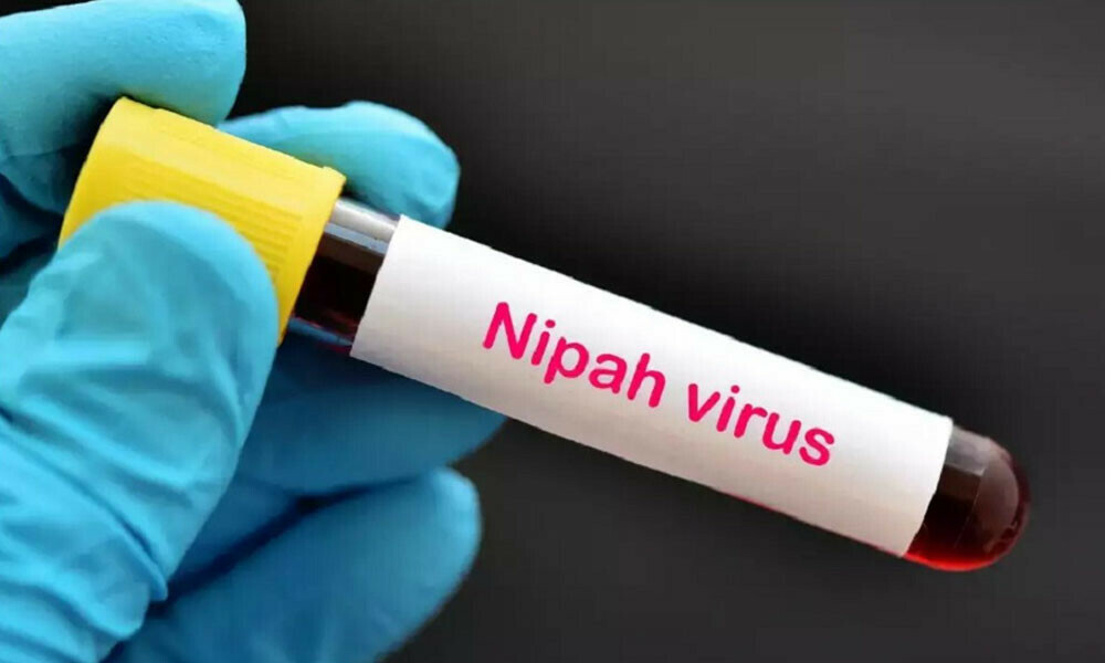Thái Lan cảnh báo trẻ nhỏ là nhóm dễ bị tổn thương nhất do virus Nipah - Ảnh 1. Thái Lan cảnh báo trẻ nhỏ là nhóm dễ bị tổn thương nhất do virus Nipah - Ảnh 1.