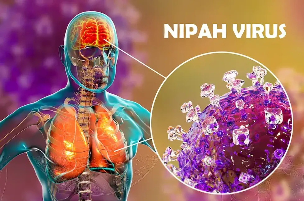 Việt Nam chưa xuất hiện ca mắc virus Nipah, Bộ Y tế sẵn sàng các biện pháp ứng phó - Ảnh 1. Việt Nam chưa xuất hiện ca mắc virus Nipah, Bộ Y tế sẵn sàng các biện pháp ứng phó - Ảnh 1.
