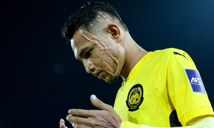 Faisal Halim lúc mới trở lại thi đấu sau ca phẫu thuật vì bị tạt axit Faisal Halim lúc mới trở lại thi đấu sau ca phẫu thuật vì bị tạt axit