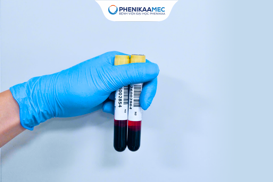 Thai 16 tuần có làm xét nghiệm NIPT được không? Giải đáp từ chuyên gia Di truyền - Ảnh 1.