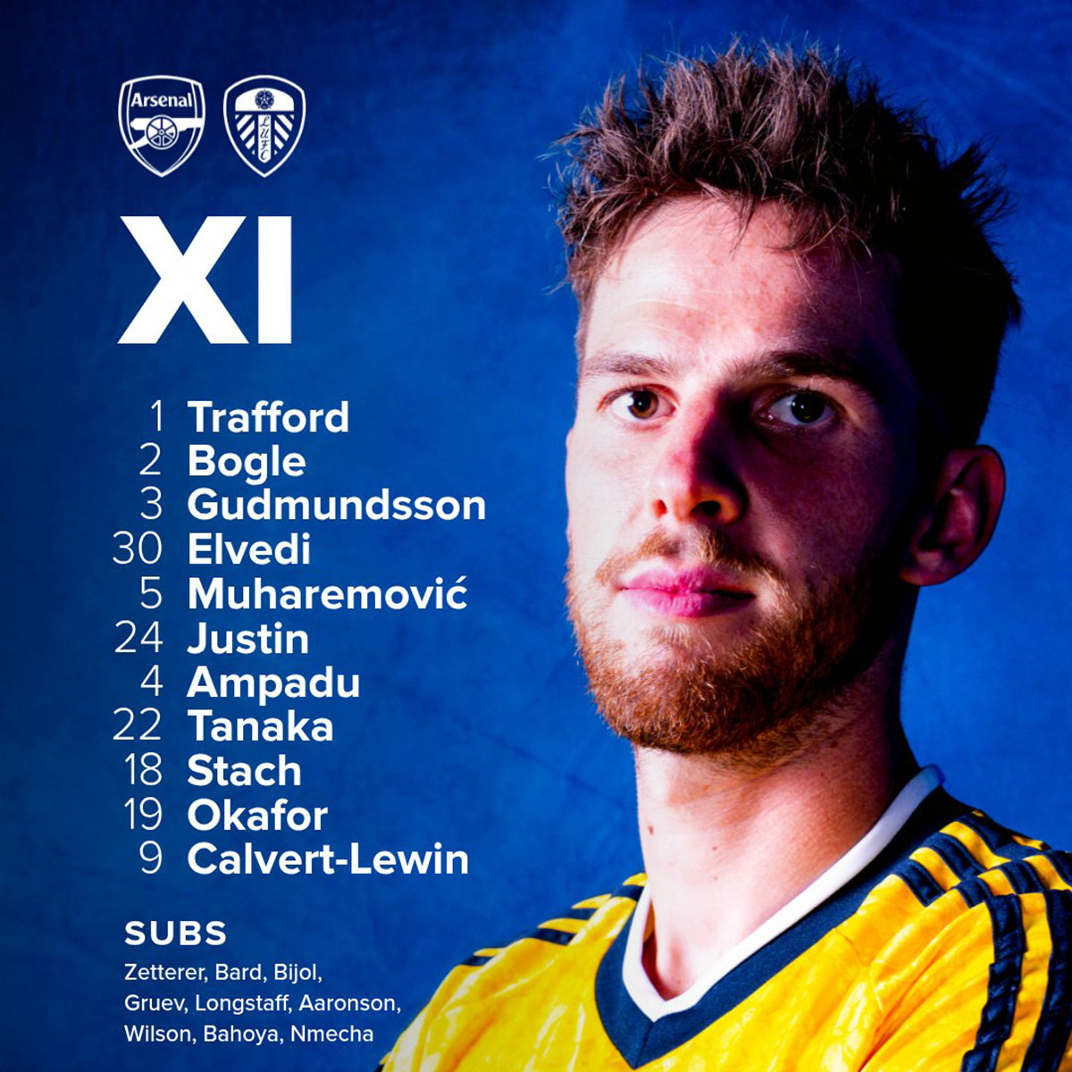 Trực Tiếp Bóng Đá Arsenal Vs Leeds (1-1, Hiệp 2): Calafiori Gỡ Hòa Doi Hinh Leeds 17916277408301249615378