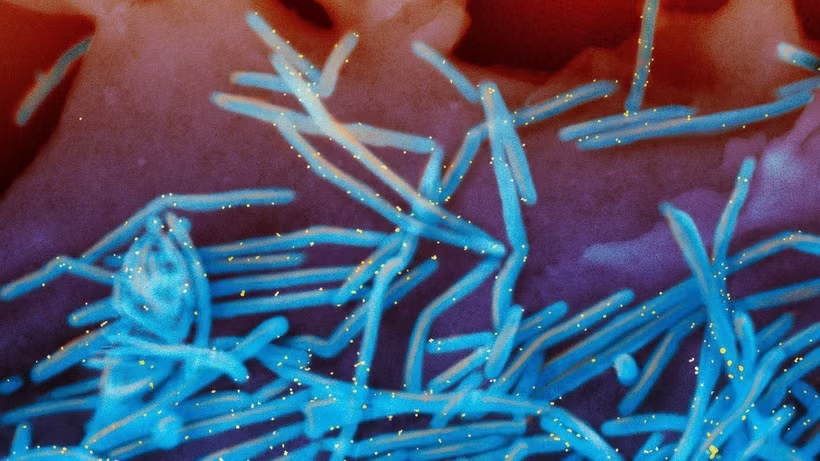 Pháp ghi nhận ca nhiễm virus hiếm gặp ở người - Ảnh 1.