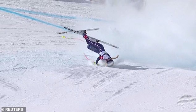 'Nữ hoàng trượt tuyết' Lindsey Vonn công bố hình ảnh X-quang kinh hoàng sau 5 ca phẫu thuật vì cú ngã ở Olympic mùa Đông - Ảnh 2. 'Nữ hoàng trượt tuyết' Lindsey Vonn công bố hình ảnh X-quang kinh hoàng sau 5 ca phẫu thuật vì cú ngã ở Olympic mùa Đông - Ảnh 2.