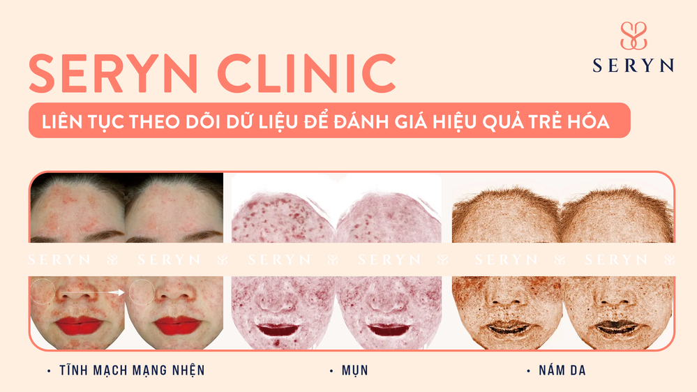 Trẻ hóa bằng dữ liệu: Vì sao thăm khám trước khi làm đẹp ngày càng được chú trọng? - Ảnh 3.