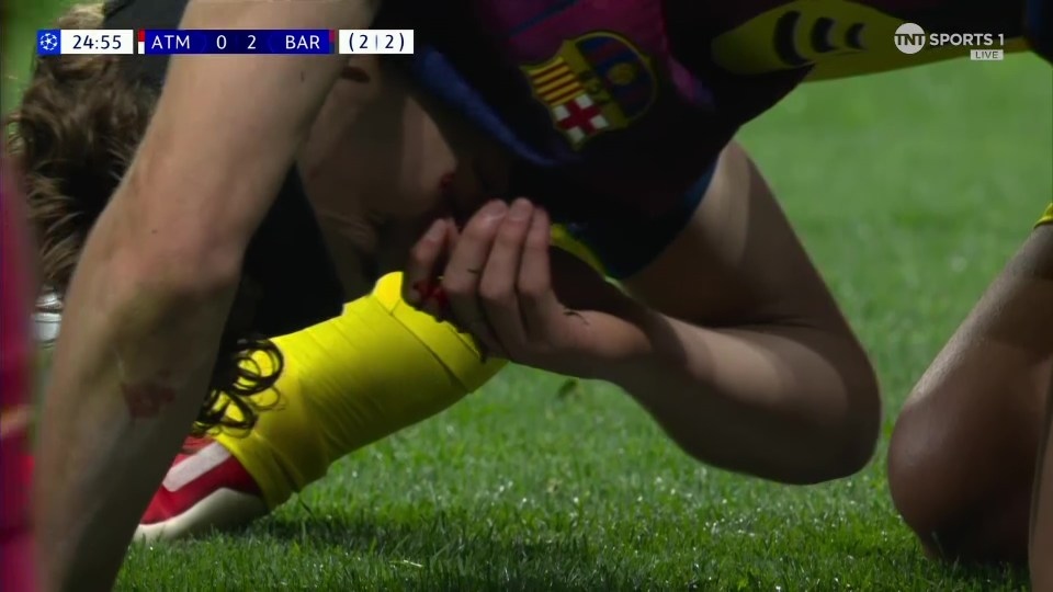 Sao Barcelona bị thủ môn Atletico Madrid đạp vào mặt trong trận đấu ở Champions League - Ảnh 4.