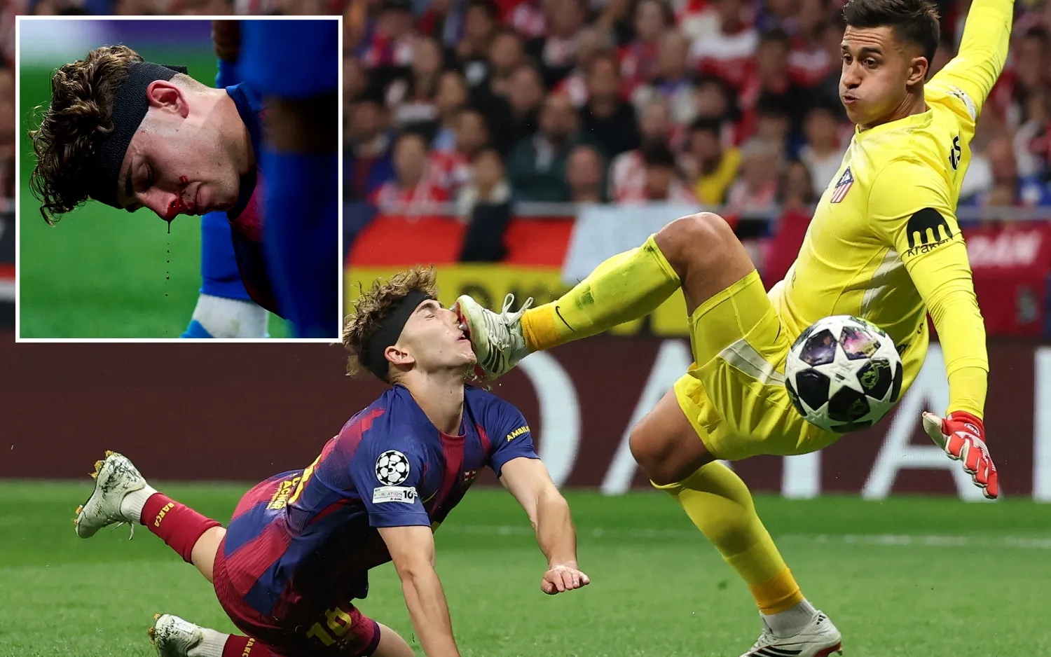 Sao Barcelona bị thủ môn Atletico Madrid đạp vào mặt trong trận đấu ở Champions League