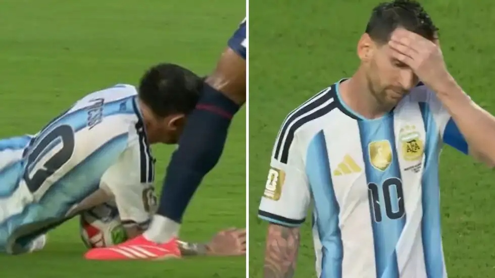 Lý do Messi bị sưng trán khi xuất hiện nhận giải Cầu thủ xuất sắc nhất trận thắng Cape Verde - Ảnh 2. Lý do Messi bị sưng trán khi xuất hiện nhận giải Cầu thủ xuất sắc nhất trận thắng Cape Verde - Ảnh 2.