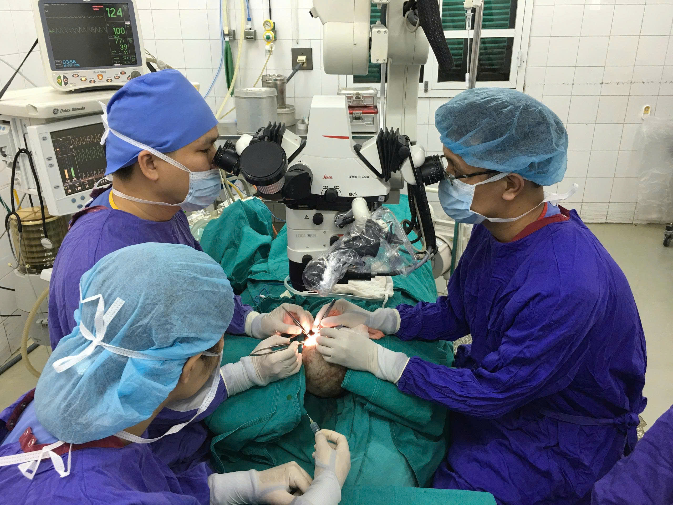 Dấu ấn vi phẫu tái tạo: 10 năm sau ca ghép lại toàn bộ da đầu cho bé gái 2 tuổi - Ảnh 2. Dấu ấn vi phẫu tái tạo: 10 năm sau ca ghép lại toàn bộ da đầu cho bé gái 2 tuổi - Ảnh 2.