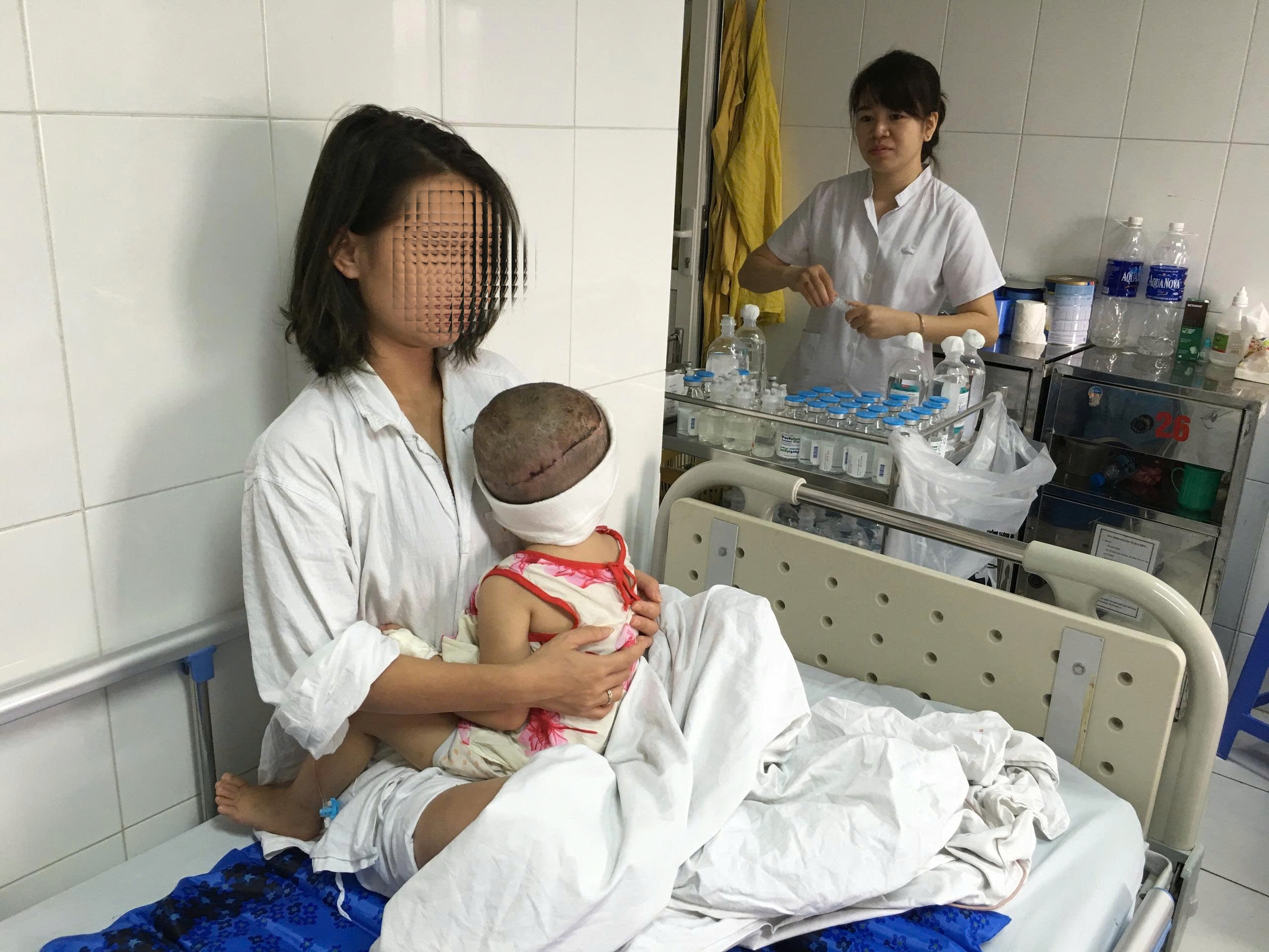 Dấu ấn vi phẫu tái tạo: 10 năm sau ca ghép lại toàn bộ da đầu cho bé gái 2 tuổi - Ảnh 3. Dấu ấn vi phẫu tái tạo: 10 năm sau ca ghép lại toàn bộ da đầu cho bé gái 2 tuổi - Ảnh 3.