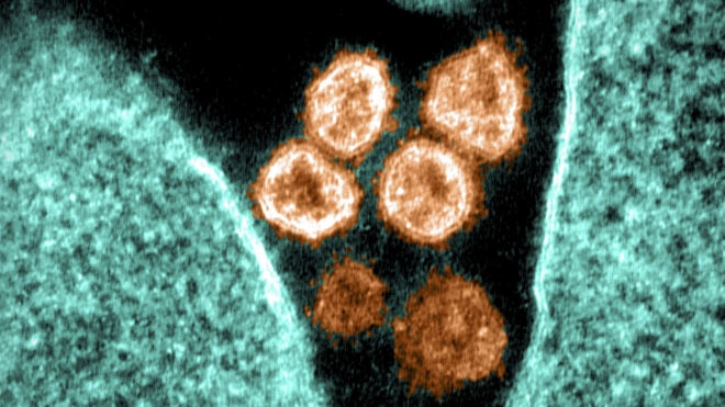 Tình báo Mỹ nói gì về nguồn gốc virus SARS-CoV-2?