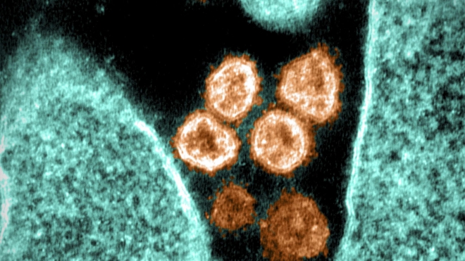 Các biến thể mới khiến virus SARS-CoV-2 nhiều hơn trong không khí