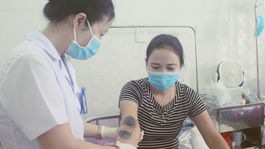Hà Nội: Số người viêm da nặng do tiếp xúc với kiến ba khoang tăng mạnh
