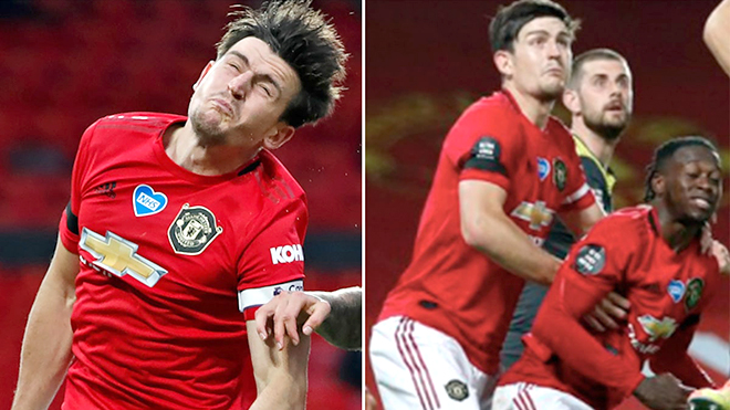 MU, Maguire, Man United, ngoại hạng Anh, truc tiep bong da hôm nay, trực tiếp bóng đá, truc tiep bong da, lich thi dau bong da hôm nay, bong da hom nay, bóng đá, bong da