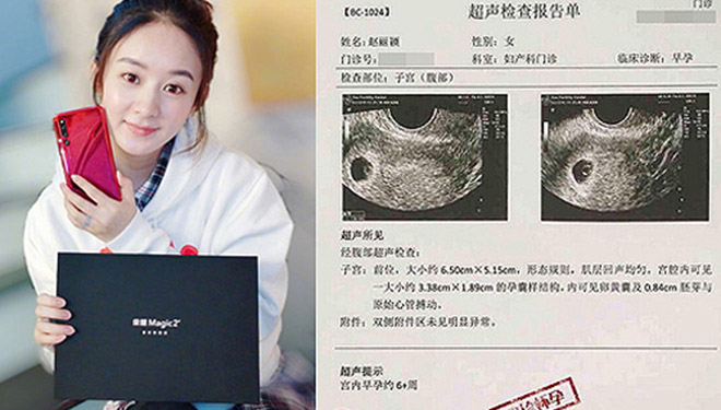 Triệu Lệ Dĩnh đang mang bầu, hình ảnh siêu âm thai nhi bị rò rỉ trên mạng