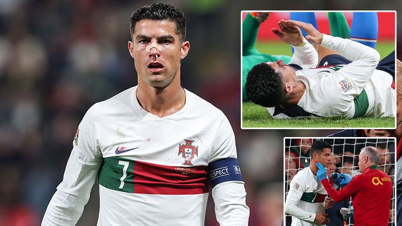 Ronaldo chấn thương, mũi bê bết máu những vẫn 'chiến' hết mình cùng Bồ Đào Nha