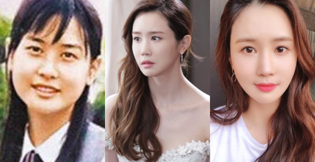Sao Hàn phẫu thuật thẩm mỹ, diễn viên Hàn, Park Min Young, Lee Da Hae, Min Hyo Ri, kim nam joo, kim hyun joong, uee, thư ký Kim sao thế