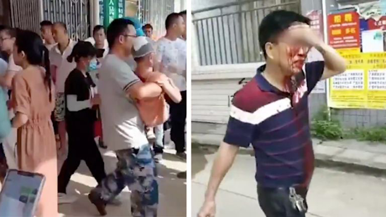 Tấn công bằng dao tại nhà trẻ ở Trung Quốc. Tấn công bằng dao tại nhà trẻ