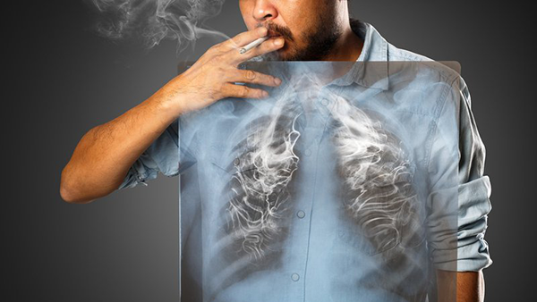 Hậu Covid-19: Bỏ thuốc và giảm tác hại thuốc lá cần xem xét thực thi song hành