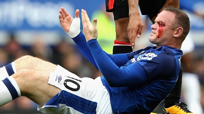 SỐC trước khuôn mặt đầm đìa máu của Rooney vì bị đánh cùi chỏ
