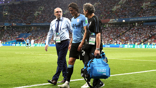 Uruguay vs Pháp: Tin mới nhất về chấn thương của Cavani 