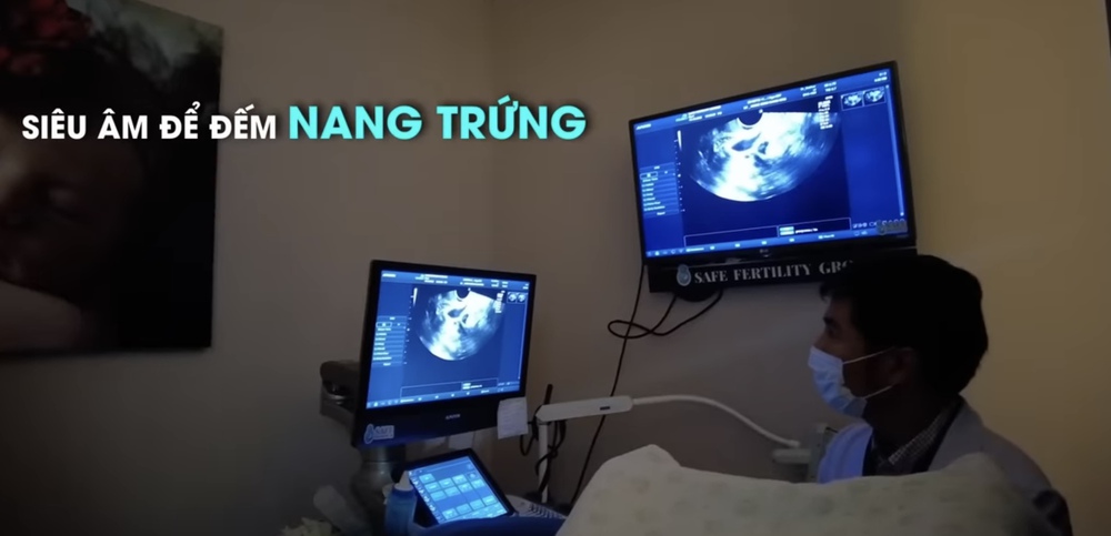 Minh Hằng tiết lộ lý do chỉ giữ được 1 phôi thai, từng bị doạ sảy 10% vì liên tục làm việc này - Ảnh 1.