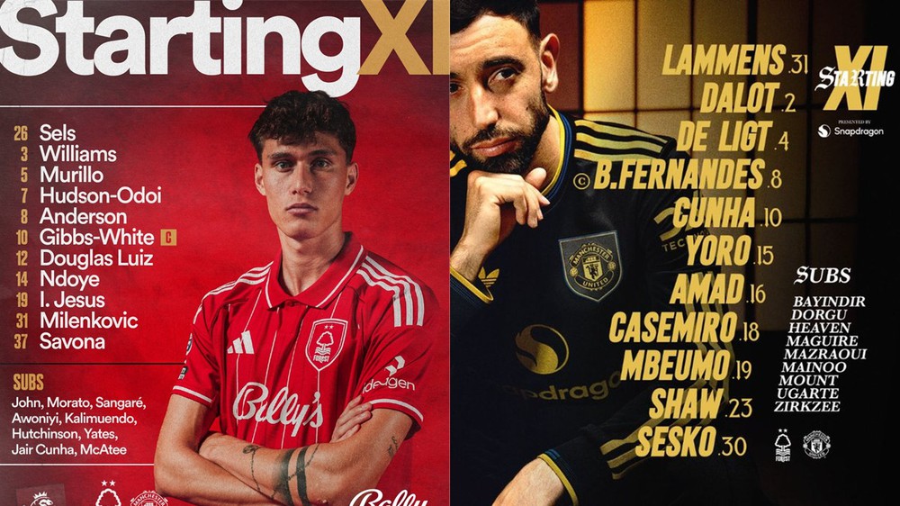 TRỰC TIẾP bóng đá Nottingham vs MU 22h hôm nay, Ngoại hạng Anh vòng 10 - Ảnh 2.