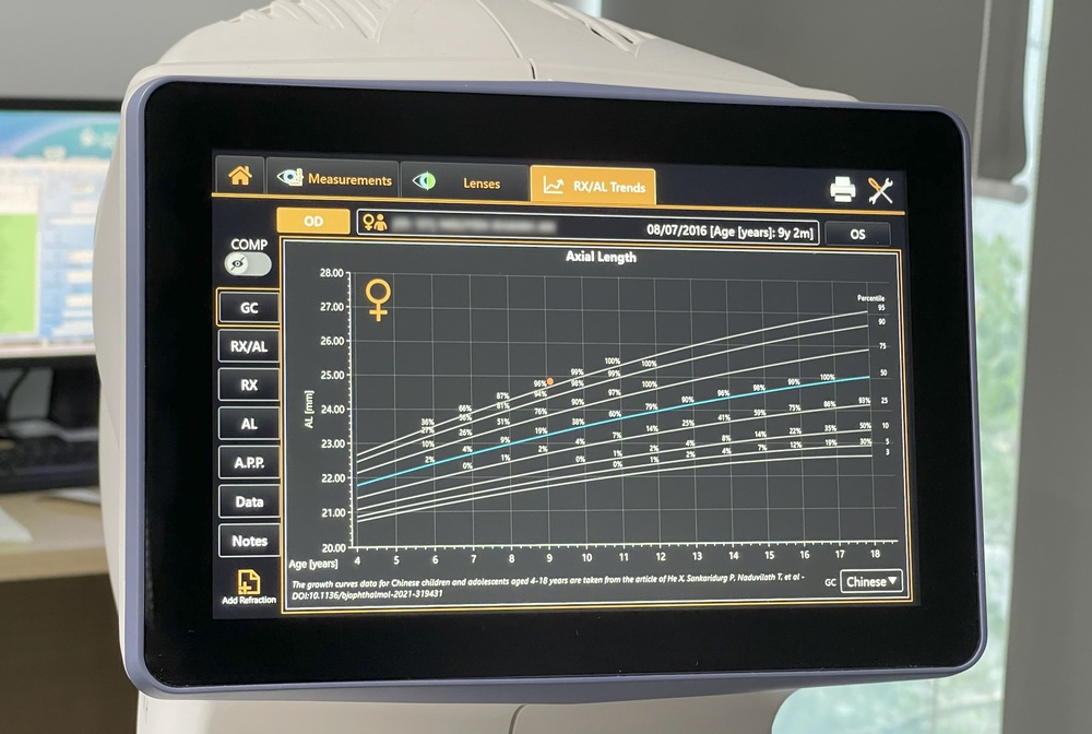 Chiều dài trục nhãn cầu và ý nghĩa đối với kiểm soát cận thị - Ảnh 2.