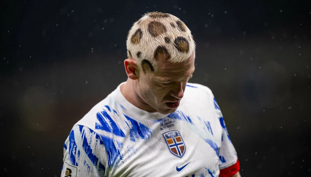 Cầu thủ Na Uy gây sốc với kiểu tóc... báo đốm ở đại chiến với ĐT Ý tại vòng loại World Cup 2026 - Ảnh 5. Cầu thủ Na Uy gây sốc với kiểu tóc... báo đốm ở đại chiến với ĐT Ý tại vòng loại World Cup 2026 - Ảnh 5.