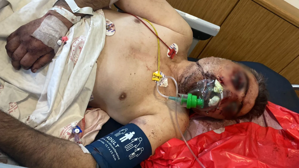 Võ sĩ quyền Anh đối mặt án tù vì cắn tài xế taxi đến hôn mê - Ảnh 2. Võ sĩ quyền Anh đối mặt án tù vì cắn tài xế taxi đến hôn mê - Ảnh 2.