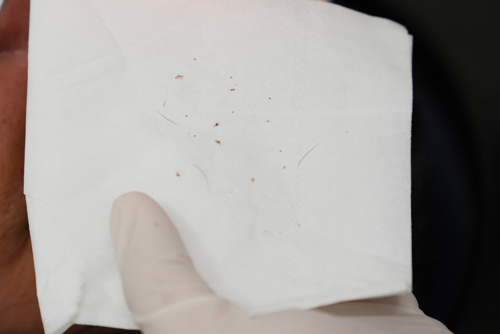 Ngứa mắt kéo dài, phát hiện rận mi ký sinh tại Bến Tre - Ảnh 2. Ngứa mắt kéo dài, phát hiện rận mi ký sinh tại Bến Tre - Ảnh 2.