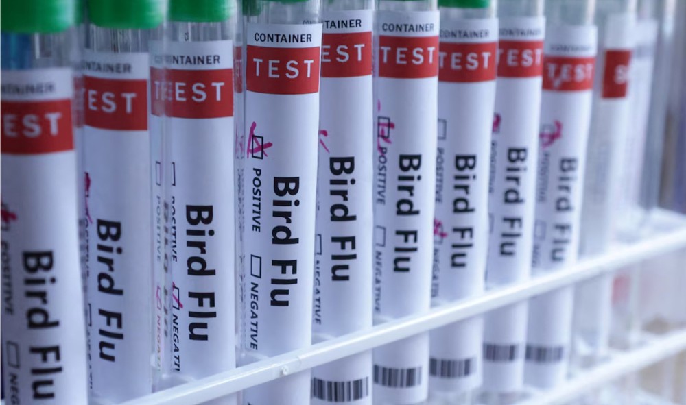 Nga cảnh báo dịch cúm A tiếp tục gia tăng - Ảnh 1. Nga cảnh báo dịch cúm A tiếp tục gia tăng - Ảnh 1.