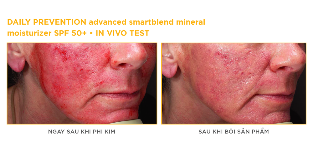 Giải pháp đột phá "all-in-one" từ kem chống nắng Exosome Imageskincare daily Prevention - Ảnh 5. Giải pháp đột phá "all-in-one" từ kem chống nắng Exosome Imageskincare daily Prevention - Ảnh 5.