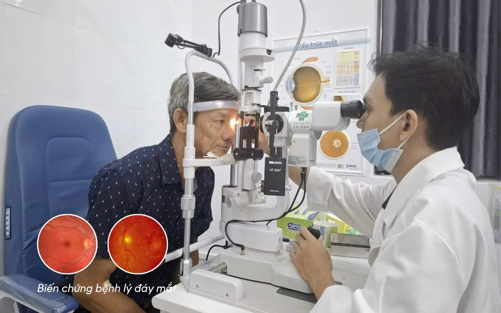 Tác hại của thuốc lá đến mắt - mối nguy đang bị bỏ quên - Ảnh 2.