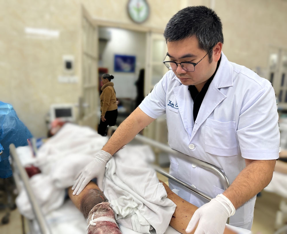 Báo động đỏ tai nạn pháo nổ: Tuần đầu năm 2026, 6 ca đa chấn thương "kinh hoàng" nhập viện - Ảnh 2.