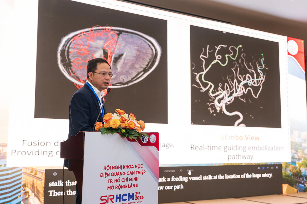 Hệ thống DSA thế hệ mới tạo bước ngoặt cho điện quang can thiệp tuyến cơ sở - Ảnh 5.
