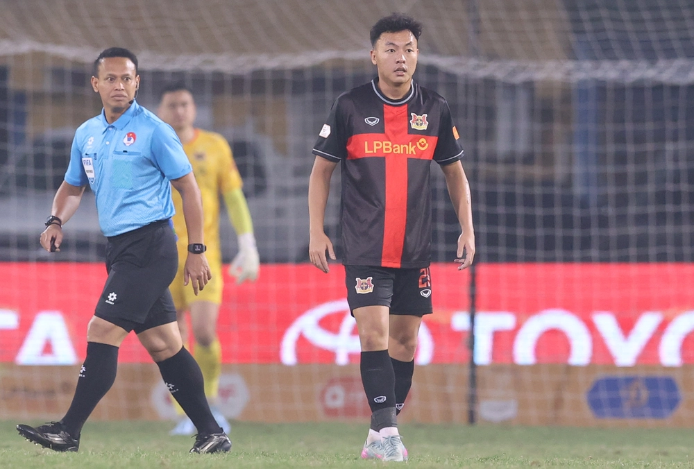 Thái Sơn đứt dây chằng, sẽ phải phẫu thuật - Ảnh 1.